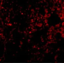 Anti-PEN2 antibody used in IHC (Paraffin sections) (IHC-P). GTX85063