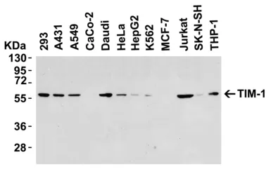 Anti-TIM-1 antibody used in Western Blot (WB). GTX85068