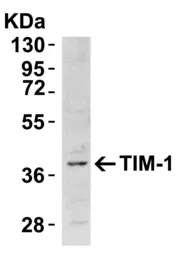 Anti-TIM-1 antibody used in Western Blot (WB). GTX85068