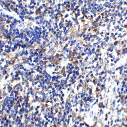 Anti-IL32 antibody used in IHC (Paraffin sections) (IHC-P). GTX85070