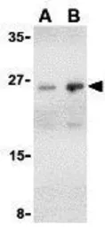 Anti-BAP29 antibody used in Western Blot (WB). GTX85072