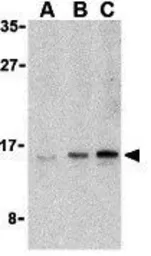 Anti-UEV1A antibody used in Western Blot (WB). GTX85082