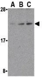 Anti-DAD1 antibody used in Western Blot (WB). GTX85083