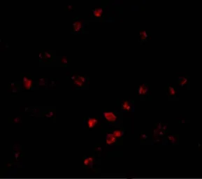 Anti-PARC antibody used in Immunocytochemistry/ Immunofluorescence (ICC/IF). GTX85085