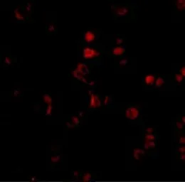 Anti-AATF antibody used in IHC (Paraffin sections) (IHC-P). GTX85086