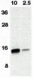 Anti-Neurturin antibody used in Western Blot (WB). GTX85089
