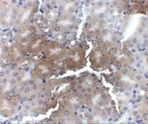 Anti-AP2M1 antibody used in IHC (Paraffin sections) (IHC-P). GTX85110