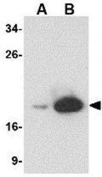 Anti-MD2 antibody [9F1B1] used in Western Blot (WB). GTX85122