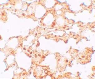 Anti-SLC39A6 antibody used in IHC (Paraffin sections) (IHC-P). GTX85131