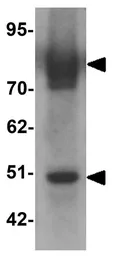 Anti-SLC39A6 antibody used in Western Blot (WB). GTX85131