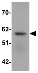 Anti-ZIP5 antibody used in Western Blot (WB). GTX85132