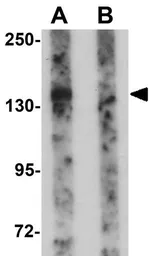 Anti-PEAR1 antibody used in Western Blot (WB). GTX85138