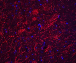 Anti-Synaptopodin antibody used in IHC (Paraffin sections) (IHC-P). GTX85140