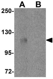 Anti-PIWIL3 antibody used in Western Blot (WB). GTX85145