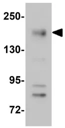 Anti-NOD4 antibody used in Western Blot (WB). GTX85160