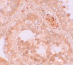 Anti-WDR92 antibody used in IHC (Paraffin sections) (IHC-P). GTX85162
