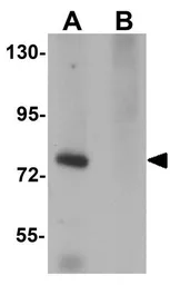 Anti-SESTD1 antibody used in Western Blot (WB). GTX85164