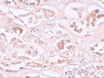Anti-ALKBH2 antibody used in IHC (Paraffin sections) (IHC-P). GTX85166