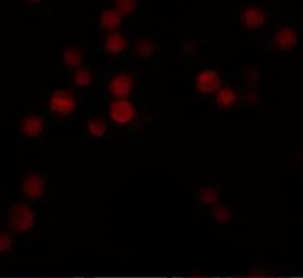 Anti-ATG9B antibody used in Immunocytochemistry/ Immunofluorescence (ICC/IF). GTX85184
