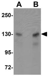 Anti-MTUS2 antibody used in Western Blot (WB). GTX85202