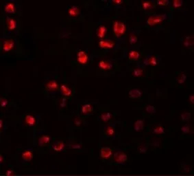 Anti-ARHGAP18 antibody used in Immunocytochemistry/ Immunofluorescence (ICC/IF). GTX85208