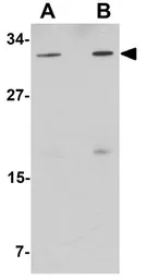 Anti-NAT11 antibody used in Western Blot (WB). GTX85214