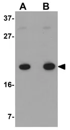Anti-OCIAD2 antibody used in Western Blot (WB). GTX85233