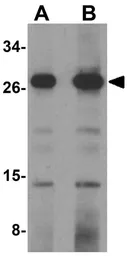 Anti-OCIAD1 antibody used in Western Blot (WB). GTX85234