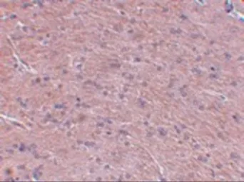 Anti-Prosapip1 antibody used in IHC (Paraffin sections) (IHC-P). GTX85249