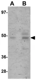 Anti-JMJD5 antibody used in Western Blot (WB). GTX85251