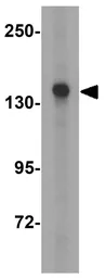 Anti-KDM3A antibody used in Western Blot (WB). GTX85253