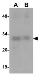 Anti-STING antibody used in Western Blot (WB). GTX85266