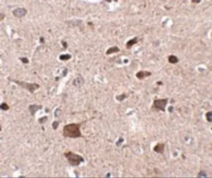 Anti-CCDC134 antibody used in IHC (Paraffin sections) (IHC-P). GTX85268