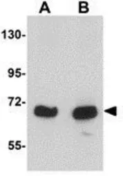 Anti-KLHL15 antibody used in Western Blot (WB). GTX85275