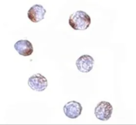 Anti-KLHL15 antibody used in Immunocytochemistry/ Immunofluorescence (ICC/IF). GTX85275
