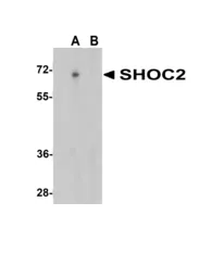 Anti-SHOC2 antibody used in Western Blot (WB). GTX85278