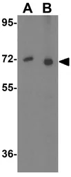 Anti-SHOC2 antibody used in Western Blot (WB). GTX85278