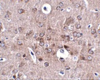Anti-PCDH18 antibody used in IHC (Paraffin sections) (IHC-P). GTX85299