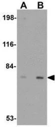 Anti-LRFN5 antibody used in Western Blot (WB). GTX85300