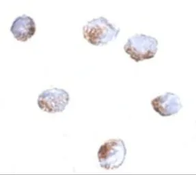 Anti-GNPDA2 antibody used in Immunocytochemistry/ Immunofluorescence (ICC/IF). GTX85346