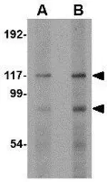 Anti-FNIP2 antibody used in Western Blot (WB). GTX85348
