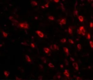 Anti-TTBK1 antibody used in IHC (Paraffin sections) (IHC-P). GTX85349