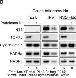 Anti-TOM70 antibody used in Western Blot (WB). GTX85353