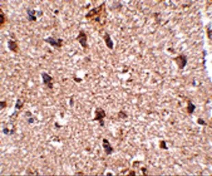 Anti-JPH3 antibody used in IHC (Paraffin sections) (IHC-P). GTX85363