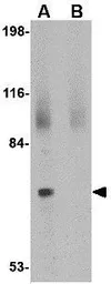 Anti-JPH2 antibody used in Western Blot (WB). GTX85367