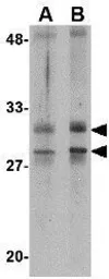 Anti-METTL7A antibody used in Western Blot (WB). GTX85369