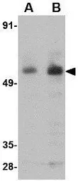 Anti-PARL antibody used in Western Blot (WB). GTX85382