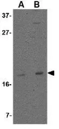 Anti-Stella antibody used in Western Blot (WB). GTX85384