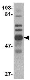 Anti-TRIM30 antibody used in Western Blot (WB). GTX85386