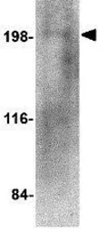 Anti-RGPD5 antibody used in Western Blot (WB). GTX85402